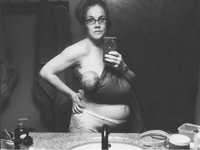Mámou 24 hodin po porodu. V pleně a s velkým břichem. Tahle fotka je hitem internetu!