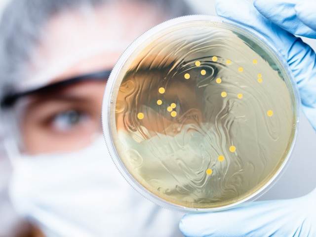 Bakterie se šíří vzduchem po celé planetě. I ty nebezpečné