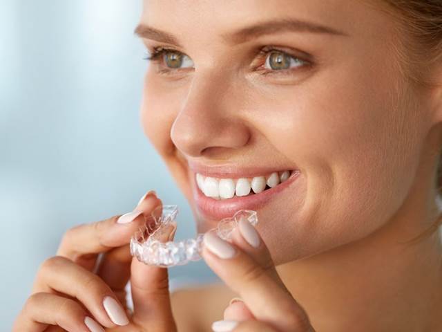 Bělení zubů doma, nebo v ordinaci? Co je potřeba pro bělostný úsměv