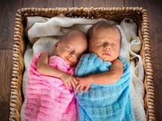 Dívky z dvojčat jsou kvůli bratrově testosteronu celý život v nevýhodě